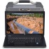 HPX-PRO Portable Digital CR SYSTEM